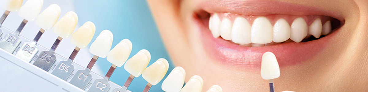 cosmetic dentist heights houston
